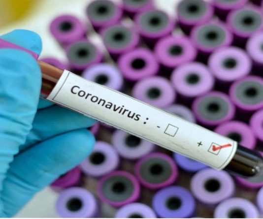 जिले में कोरोना वायरस रोकथाम एवं बचाव हेतु कार्यवाही जारी,जिले में अभी तक नही मिला है कोरोना वायरस का एक भी रोगी,पन्ना से संवाद न्यूज ब्यूरो दीपक शर्मा की रिर्पोट